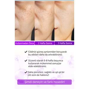 Retinol Göz Çevresi Alın Çizgisi Kırışıklık Karşıtı Serum Xella Series A220