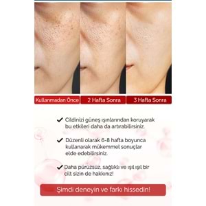 Kırışıklık Karşıtı Serum Botox Etkili Göz Çevresi ve Kaz Ayağı İçin Kolajen Vega Series A230