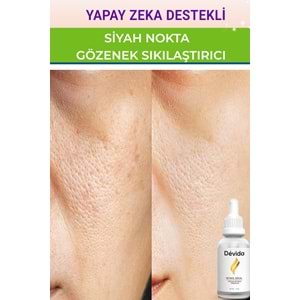 Siyah Nokta ve Sivilce Karşıtı 2 li Serum Seti