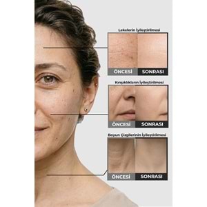 Retinal Shot Krem Göz Çevresi Alın Çizgisi Kırışıklık Karşıtı Pro Series C110