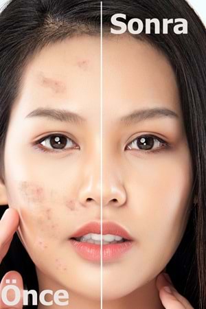 Leke Karşıtı Aydınlatıcı Canlandırıcı Serum BrightFix Series A200