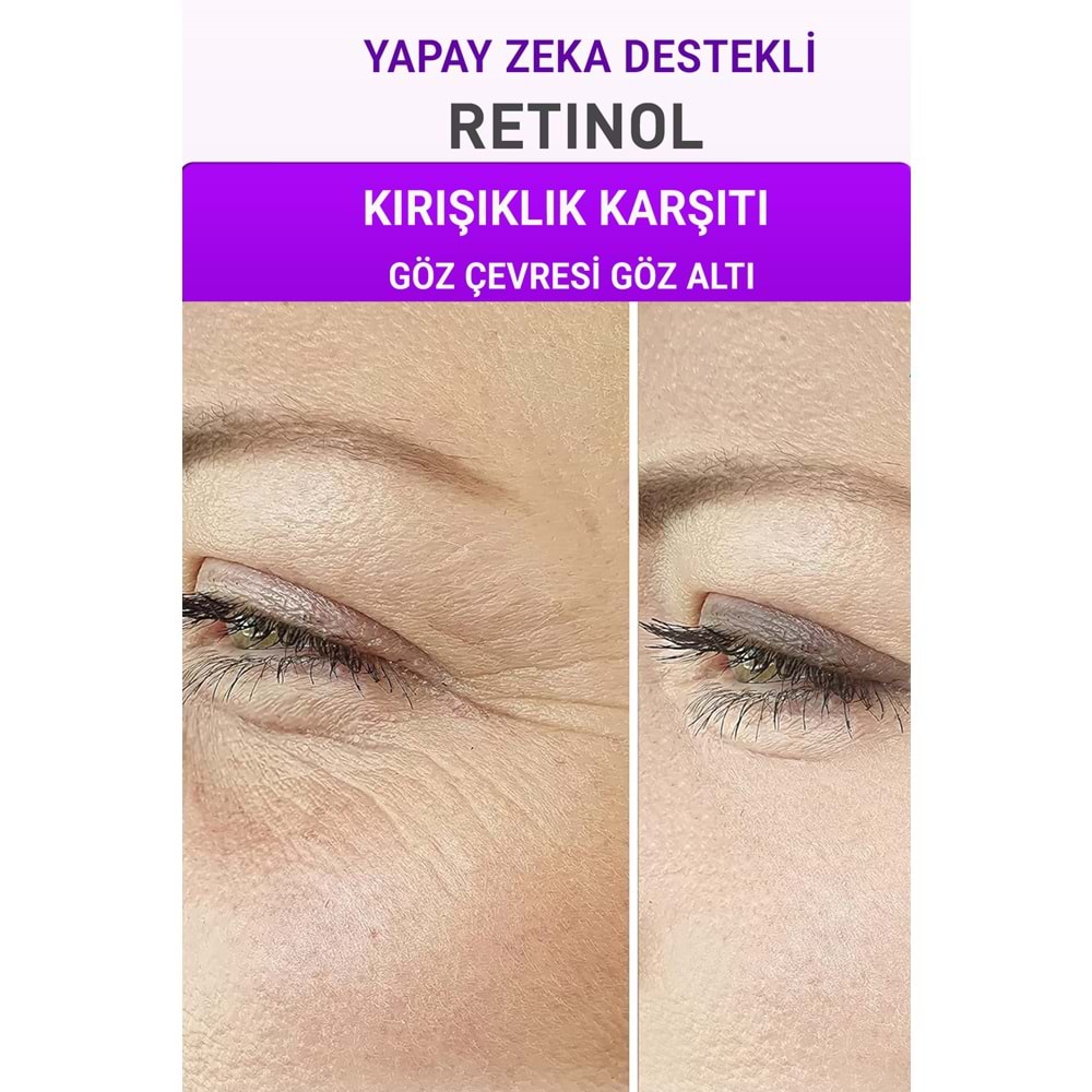 Retinol + Gözenek ve Siyah Nokta Önleyici 2'li Bakım Seti