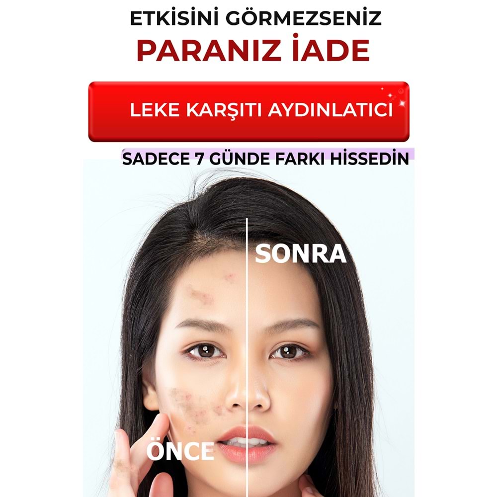 Siyah Nokta Karşıtı ve Leke Karşıtı Yüz Bakım Serumu 2 li set